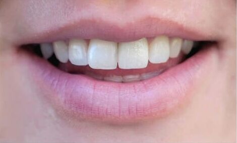 Cosmetic Dentistry 1