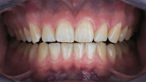 Cosmetic Dentistry Cosmetic Dentistry