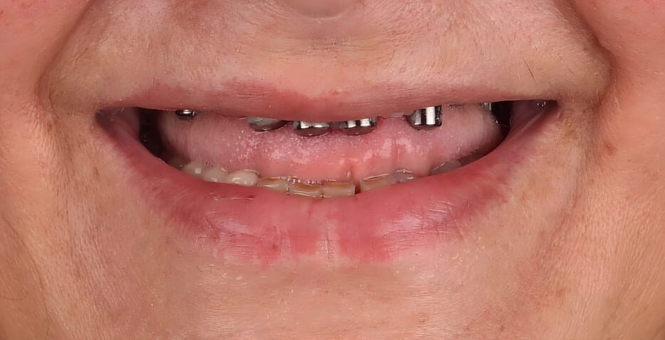 Restorative Procedures 1 Restorative Procedures 1