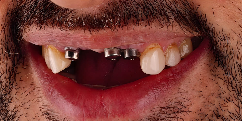 Restorative Procedures Restorative Procedures